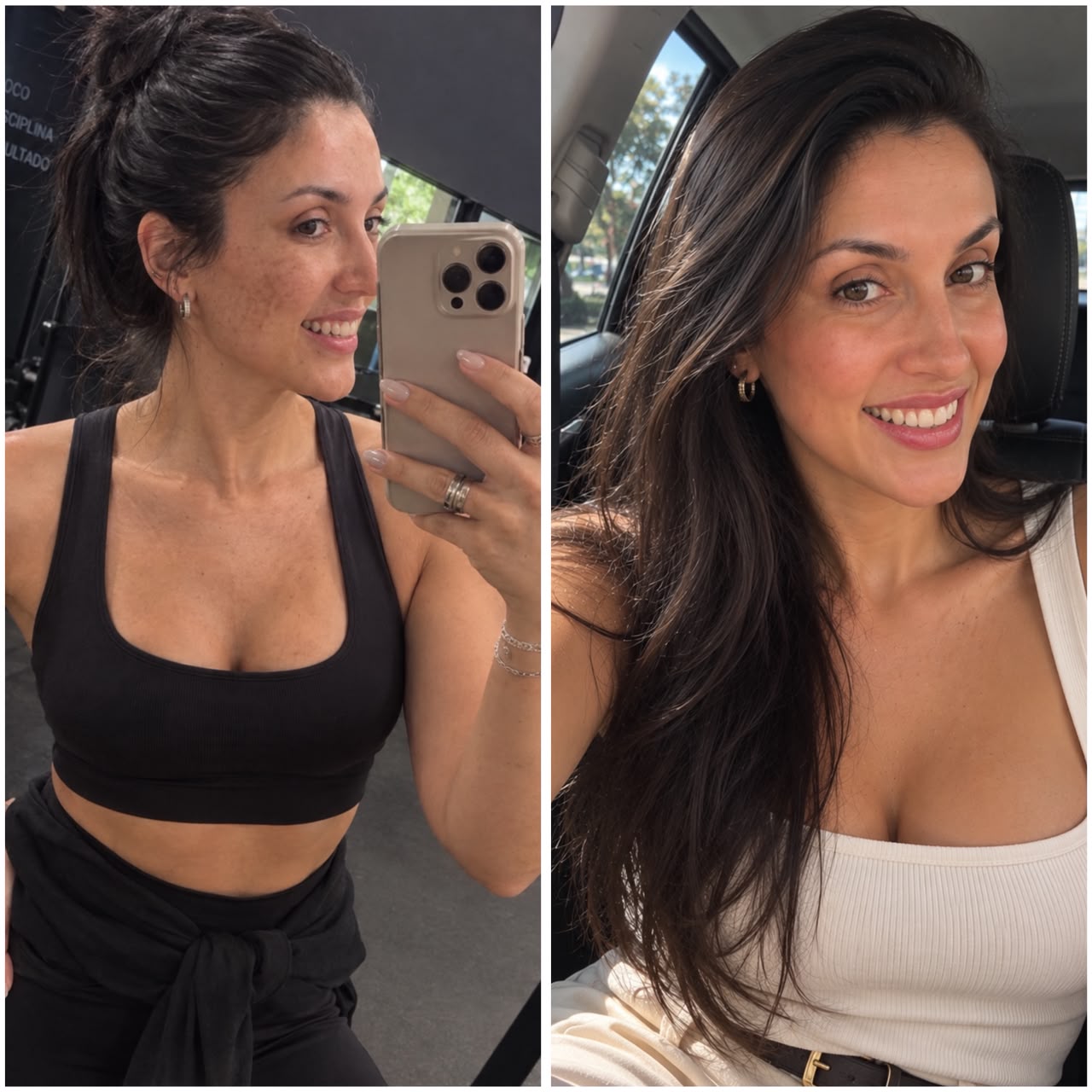 Foto de antes e depois da pele